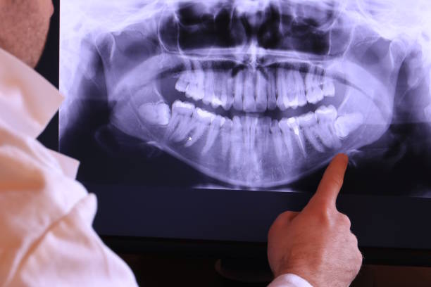 Best Walk-In Emergency Dental Services in Chehalis, WA