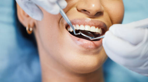 Best Emergency Treatment for Oral Infections in Chehalis, WA