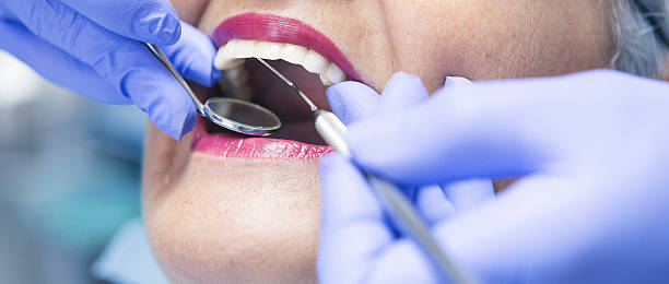 Best Broken or Chipped Tooth Repair in Chehalis, WA